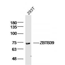 Anti-ZBTB39 antibody