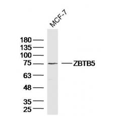 Anti-ZBTB5 antibody