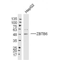 Anti-ZBTB6 antibody