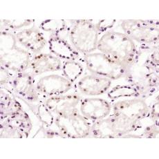Anti-ZCCHC4 antibody
