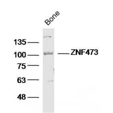 Anti-ZFP100 / ZNF473 antibody