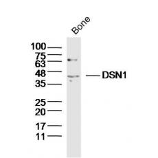 Anti-DSN1 antibody