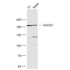Anti-DUOX1 antibody