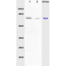 Anti-DVL1 antibody