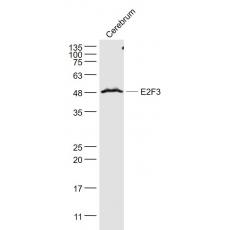 Anti-E2F3 antibody