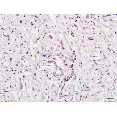Anti-E2F5 antibody