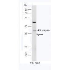 Anti-E3 ubiquitin ligase antibody