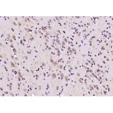 Anti-EB2 antibody