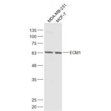 Anti-ECM1 antibody