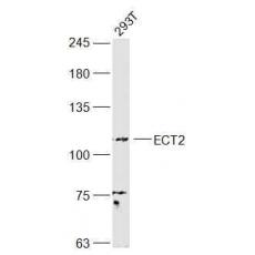 Anti-ECT2 antibody