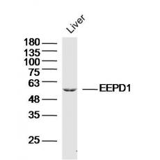 Anti-EEPD1 antibody