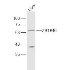Anti-ZBTB46 antibody