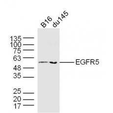 Anti-EGFR5 antibody