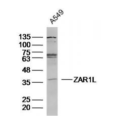 Anti-ZAR1L antibody