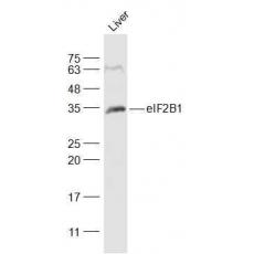 Anti-eIF2B1 antibody