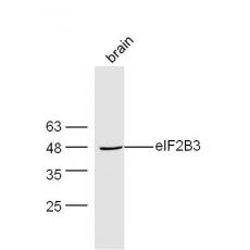 Anti-eIF2B3 antibody