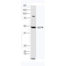 Anti-ELP4 antibody