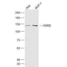 Anti-EMR2 antibody