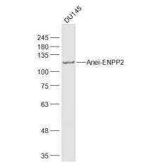 Anti-ENPP2 antibody