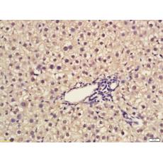 Anti-Egr1 antibody