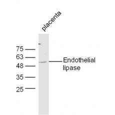 Anti-Endothelial lipase antibody
