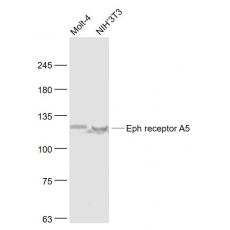 Anti-Eph receptor A5 antibody