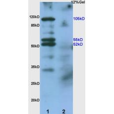Anti-EphA2 antibody