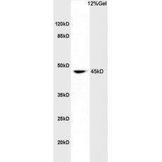Anti-EphA7 antibody