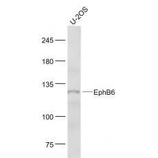 Anti-EphB6 antibody