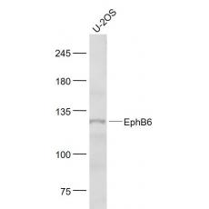 Anti-EphB6 antibody