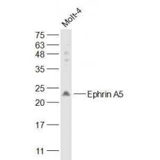 Anti-Ephrin A5 antibody