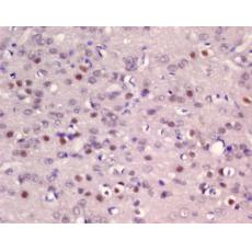 Anti-ER81 antibody
