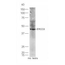 Anti-ERCC8 antibody