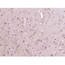 Anti-EphA3 antibody