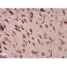 Anti-Ermin antibody