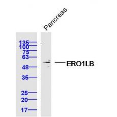 Anti-ERO1LB antibody