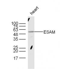 Anti-ESAM antibody