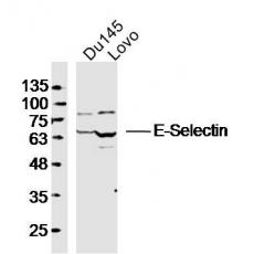 Anti-E-Selectin antibody