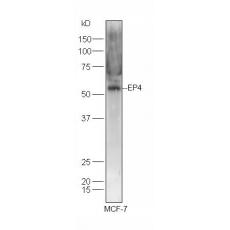 Anti-EP4 antibody