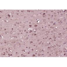 Anti-ESYT1 antibody