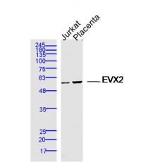 Anti-EVX2 antibody