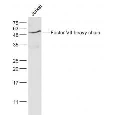 Anti-Factor VII heavy chain antibody