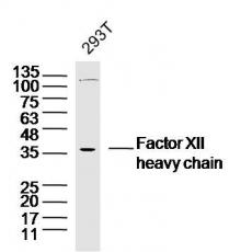Anti-Factor XIIa heavy chain antibody