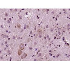 Anti-FADD antibody