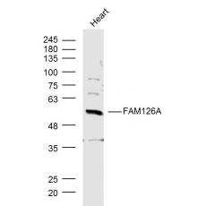Anti-FAM126A antibody