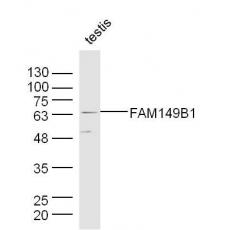 Anti-FAM149B1 antibody