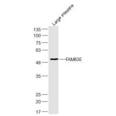 Anti-FAM83E antibody