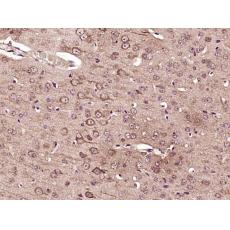Anti-FAM98C antibody