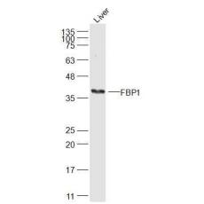 Anti-FBP1 antibody