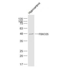 Anti-FBXO25 antibody